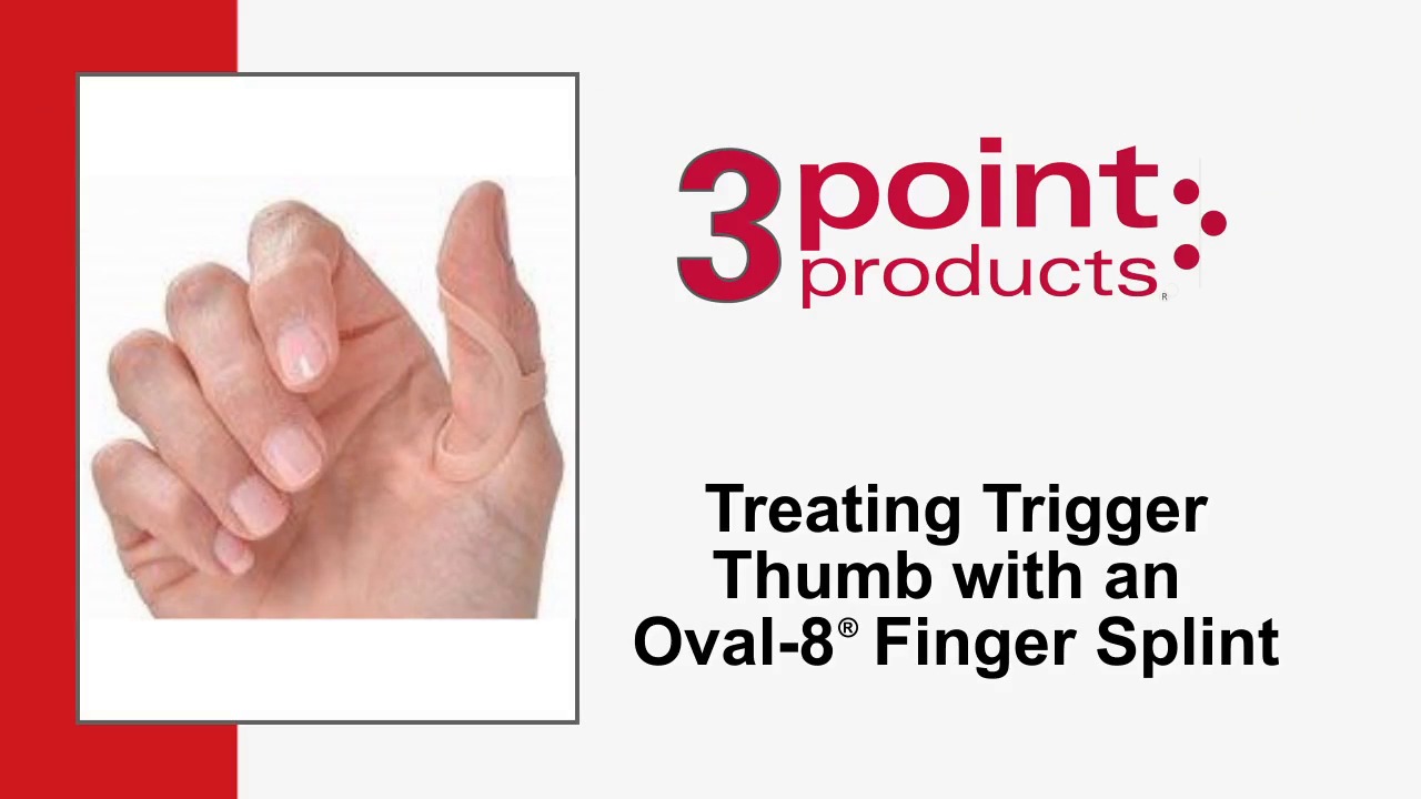 How to Treat a Trigger Thumb with an Oval-8 Finger Splint