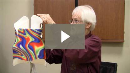 About the form and fit of your scoliosis brace