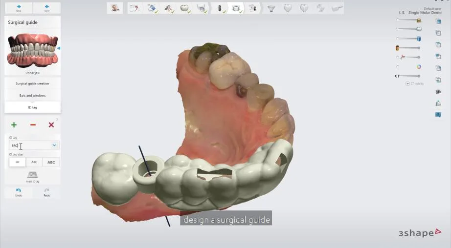 Tutustu 46+ Imagen 3shape Implant Studio - Abzlocal Fi