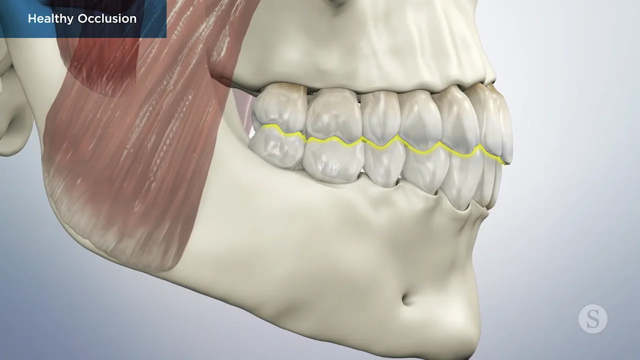 SP087 Healthy Occlusion