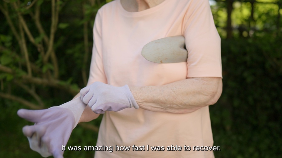 A patient's experience with a small incision aiding in quick recovery