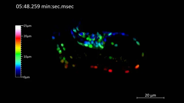 ZEISS Lattice Lightsheet 7 - C.elegans 1