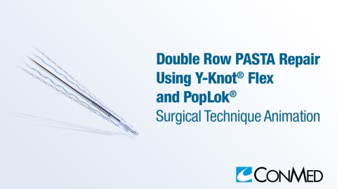 Double Row PASTA Repair Using Y-Knot® Flex and PopLok®