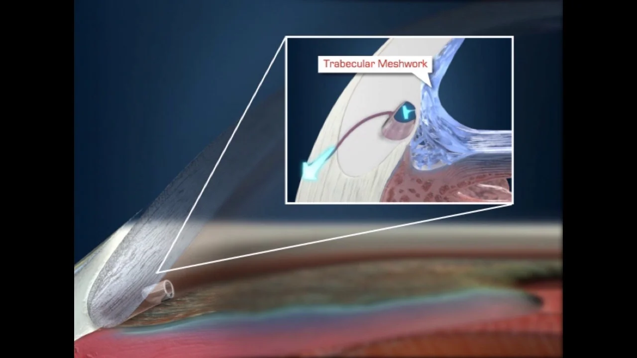 Kathy Lo／Osculum Infame Kathy Lo／Osculum Infame Osculum Infame (the Shameful Kiss