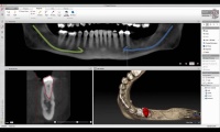 Accurate diagnostics and treatment planning through combination of 2D and 3D views.