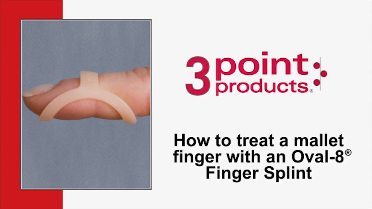 How to Treat a Mallet Finger with an Oval-8 Finger Splint