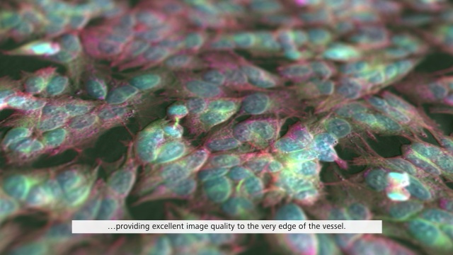 Streamlined Imaging with Celldiscoverer 7