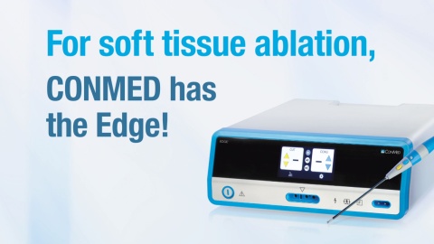 Edge® Bipolar Arthroscopic RF System - Product Video