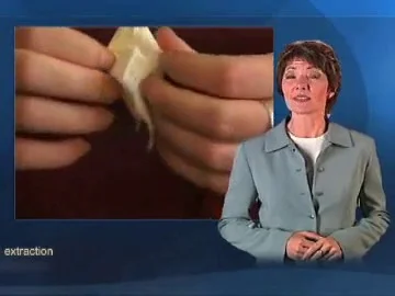 Tooth Extraction Rockford Grand Rapids Extract Teeth Damage Teeth