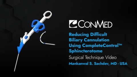 Dr. Sachdev - Reducing Difficult Biliary Cannulation Using CompleteControl™