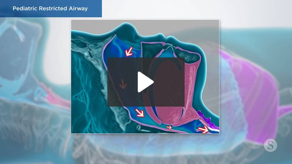 pediatric restricted airway