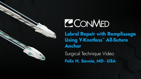 Labral Repair with Remplissage Using Y-Knotless™ All-Suture Anchor - Felix H. Savoie, MD