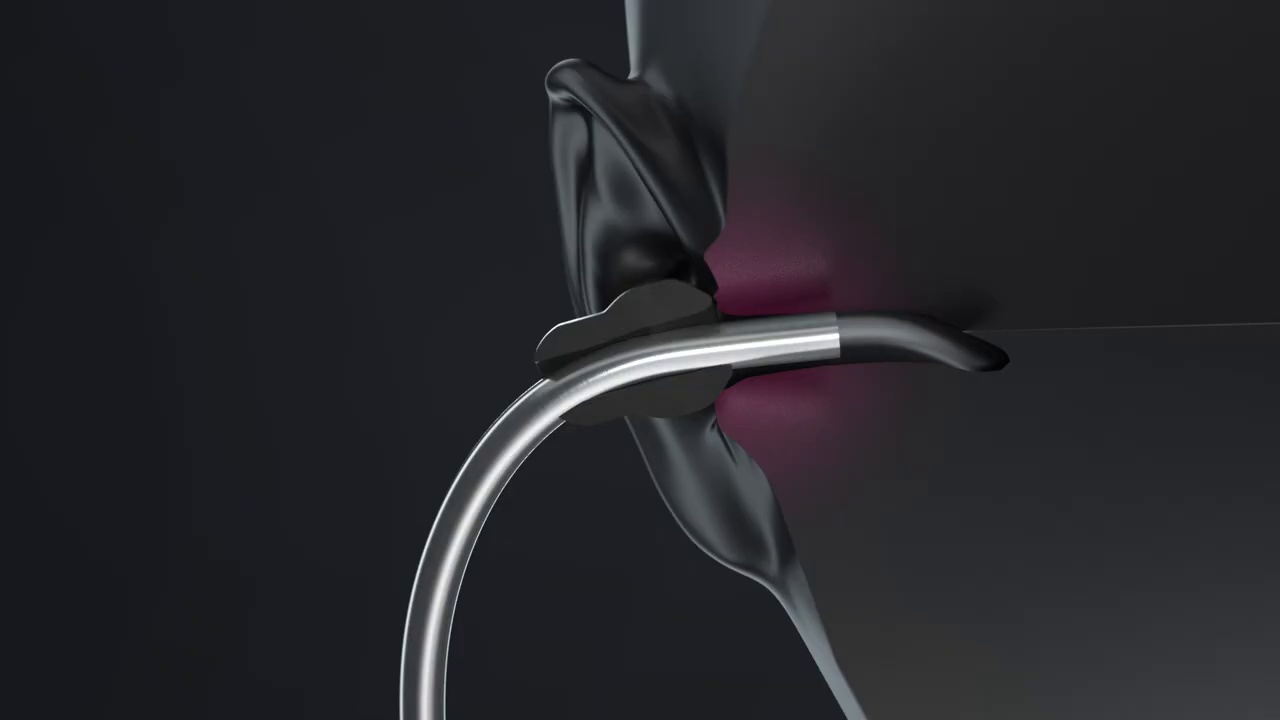 Acoustica® Pink Stethoscope Pinkalloy and Cosmo