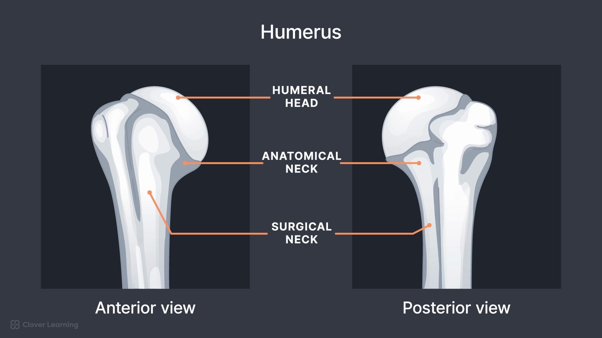 MRI Shoulder (Anatomy & Pathology) | Video Lesson | Clover Learning