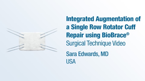 Dr. Edwards - Integrated Augmentation of a Single Row Rotator Cuff Repair using BioBrace®