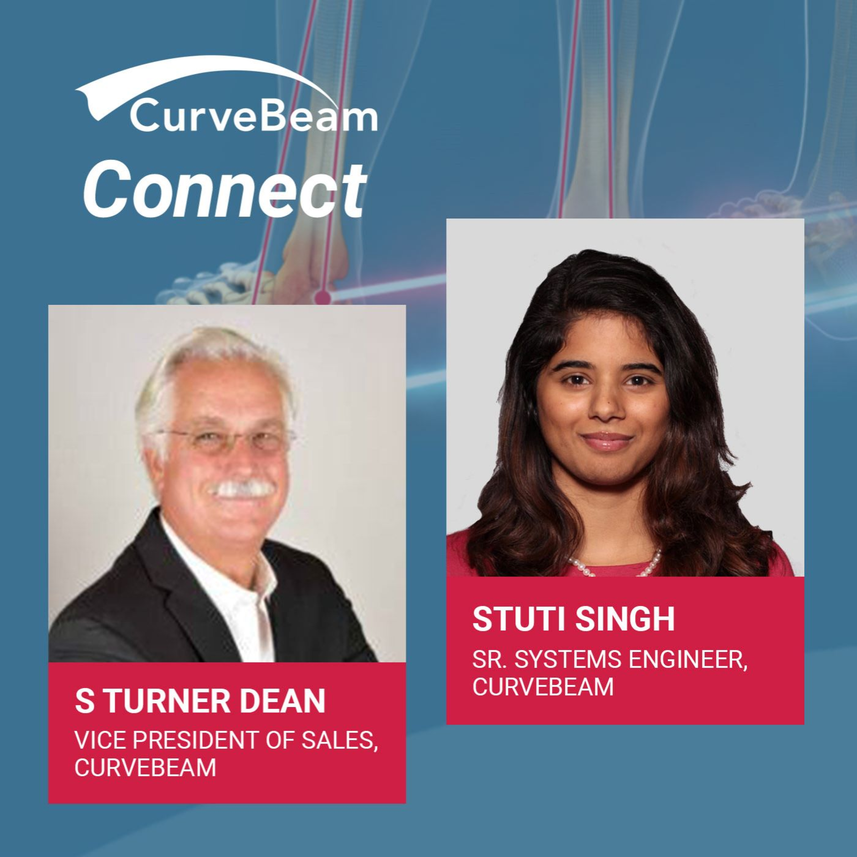 CurveBeam AI Cast