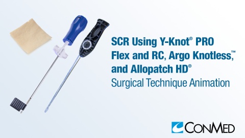 SCR Using Y-Knot® PRO Flex, Y-Knot® PRO RC, Argo Knotless®, and Allopatch HD®