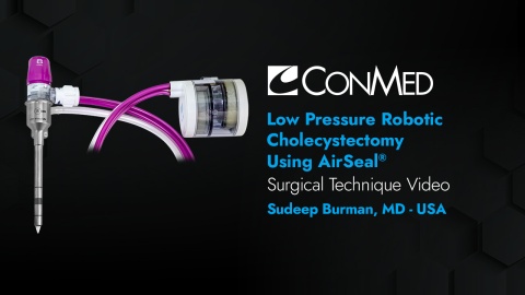 Dr. Burman - Low Pressure Robotic Cholecystectomy Using AirSeal®