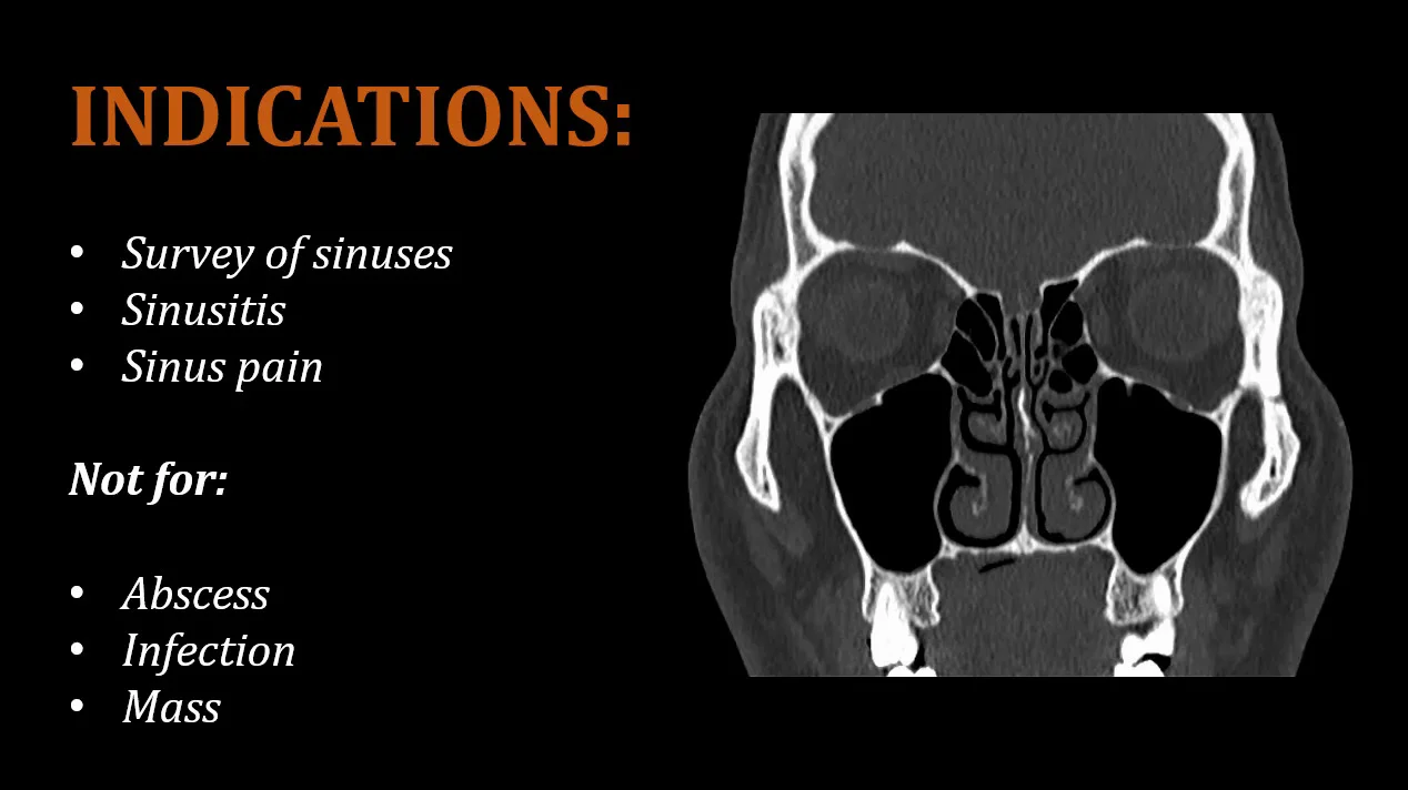 Basics of CT Scan interpretation of paranasal sinuses.pptx, image size:1268x712