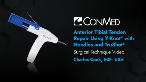Dr. Cook - Anterior Tibial Tendon Repair Using Y-Knot® with Needles, TruShot® with Y-Knot®, and GENESYS Matryx®
