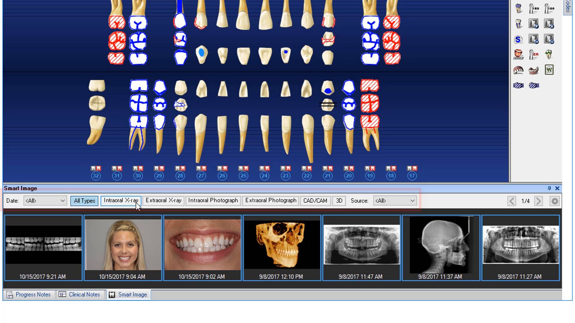 how can i open cdr dicom from dentrix