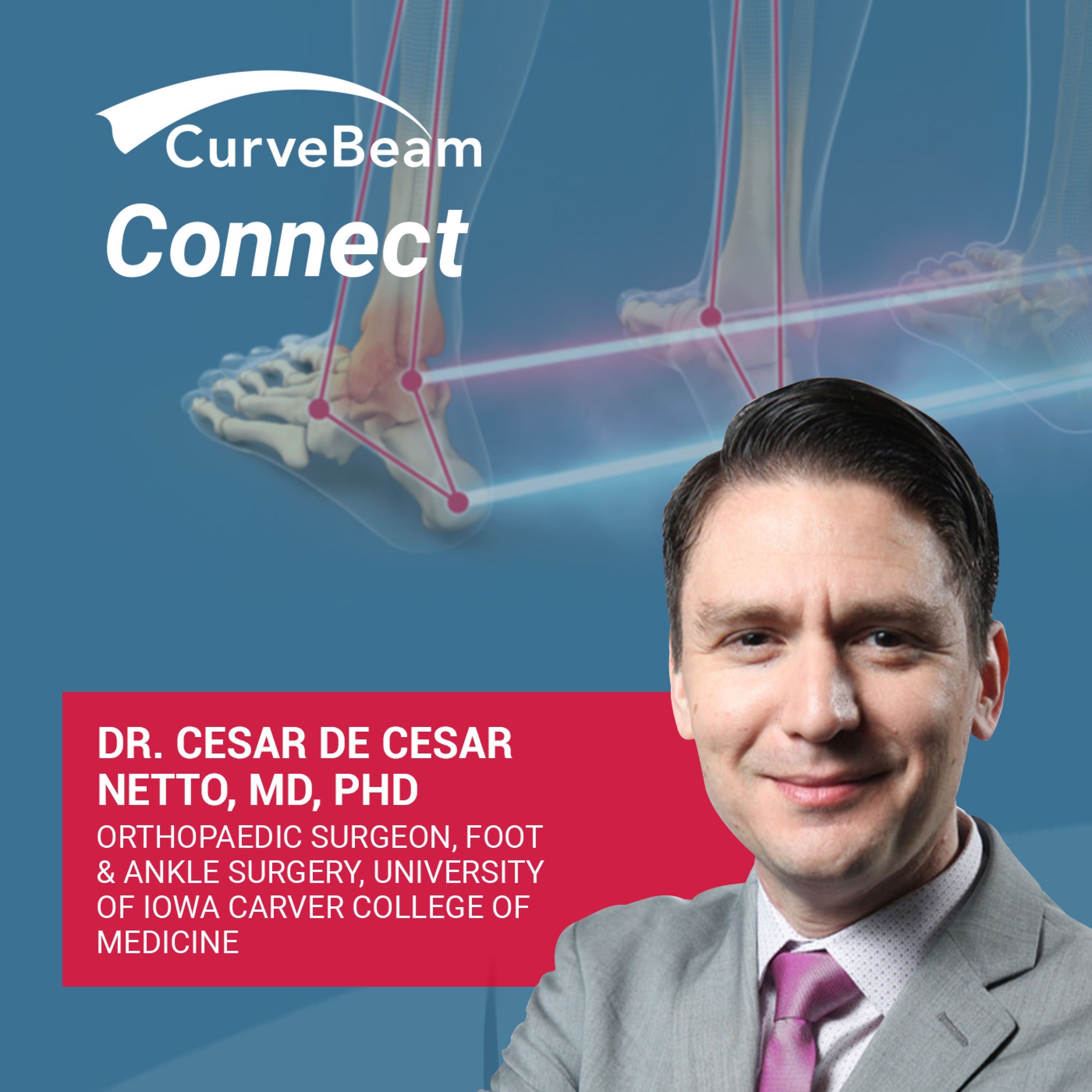 CurveBeam AI Cast
