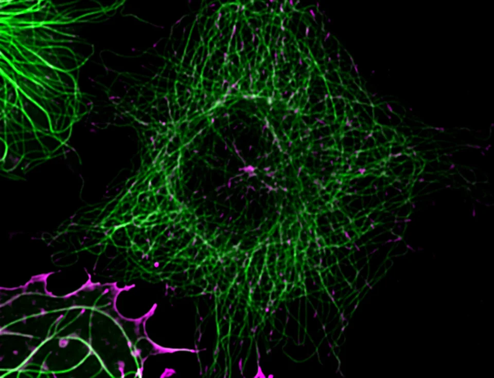 ZEISS Lattice Lightsheet 7 - COS-7 cell calnexin memerald eb3 tdtomato