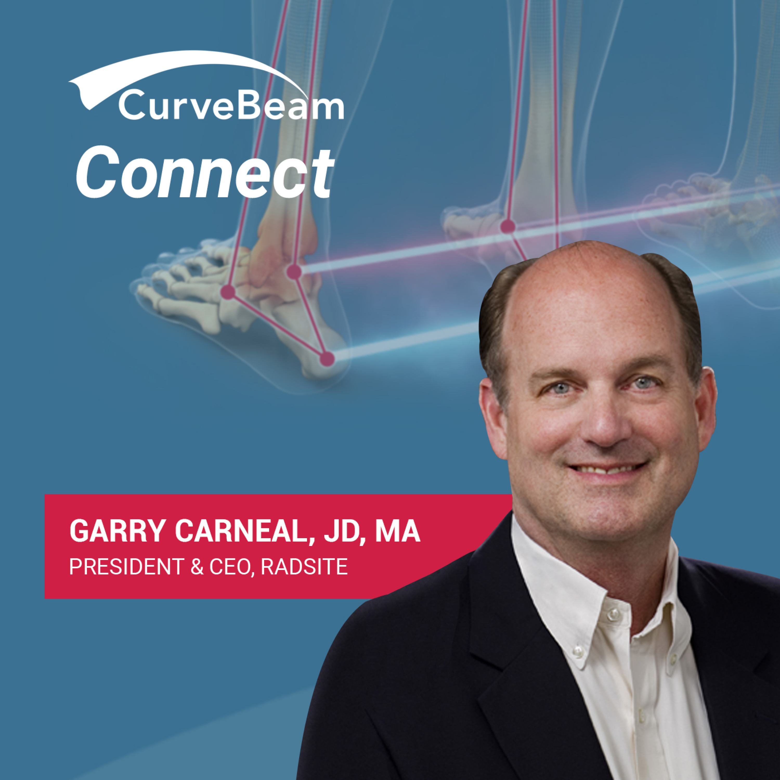 CurveBeam AI Cast