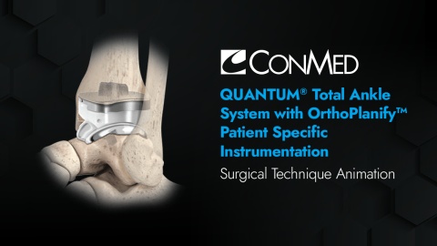 QUANTUM® Total Ankle System with OrthoPlanify™ Patient Specific Instrumentation