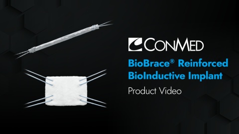 BioBrace® Reinforced Implant - Product Video