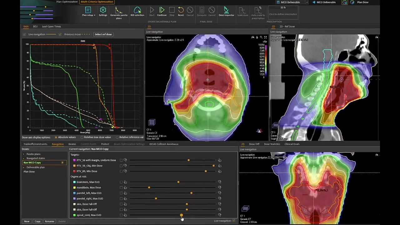 TomoTherapy in RayStation