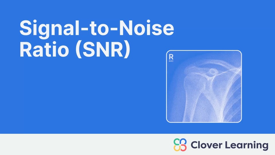 Signal-to-Noise Ratio (SNR) | Video Lesson | Clover Learning