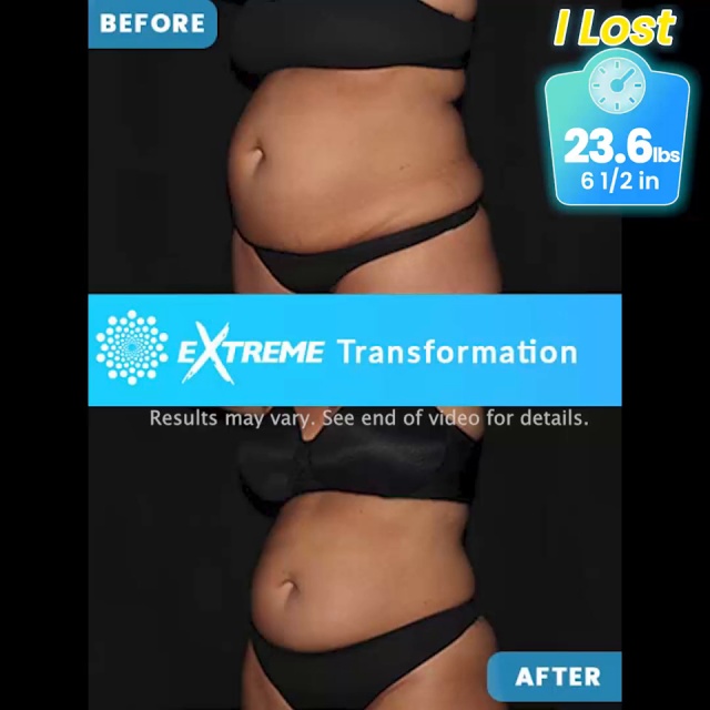 Transformation of the Week: Toning the Abdomen With CoolTone - The Body  Squad