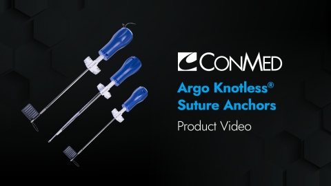 Argo Knotless® Suture Anchor - Product Video