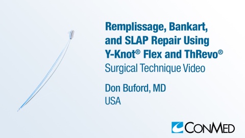 Dr. Buford - Remplissage, Bankart, and SLAP Repair Using Y-Knot® Flex and ThRevo®