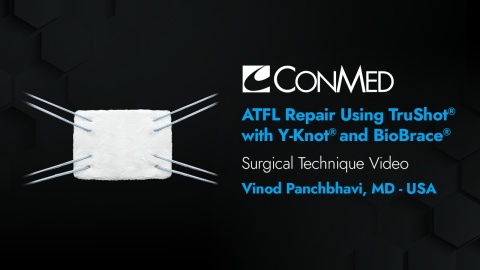 Dr. Panchbhavi - ATFL Repair Utilizing TruShot® with Y-Knot® and BioBrace® Implant