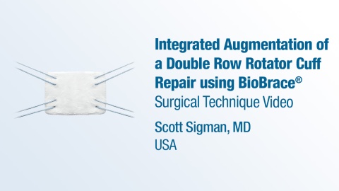 Dr. Sigman - Integrated Augmentation of a Double Row Rotator Cuff Repair using BioBrace®