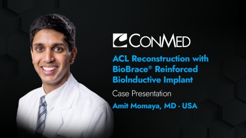ACL Reconstruction with the BioBrace® Implant - Amit Momaya, MD