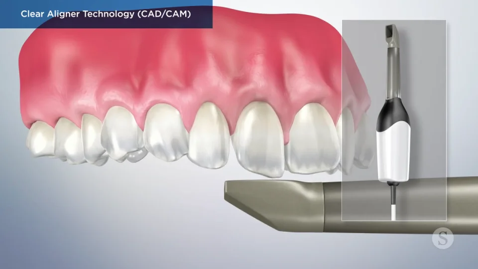 Invisalign Highland Park, IL, Clear Braces