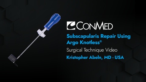 Dr. Abeln - Subscapularis Repair Using the Argo Knotless® Anchor