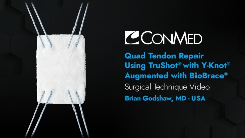 Dr. Godshaw - Quad Tendon Repair using TruShot® with Y-Knot® Augmented with BioBrace® BioInductive Implant