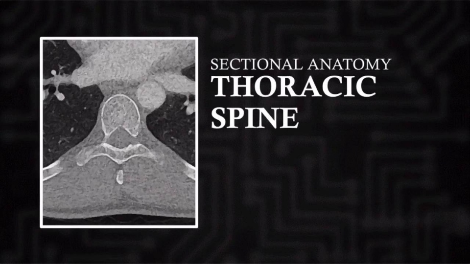 CT Thoracic (Axial) | Video Lesson | Clover Learning