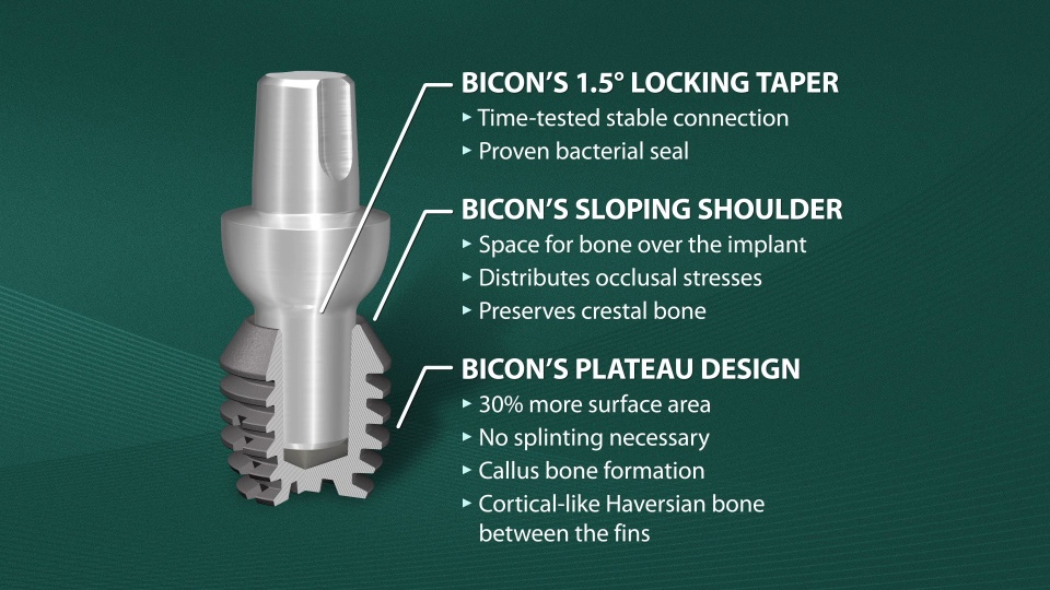 Bicon Dental Implants | Product Information | SHORT® Implants