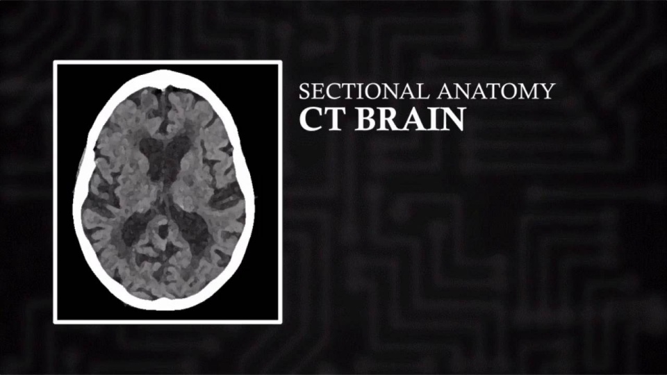 CT Brain (Axial) | Video Lesson | Clover Learning