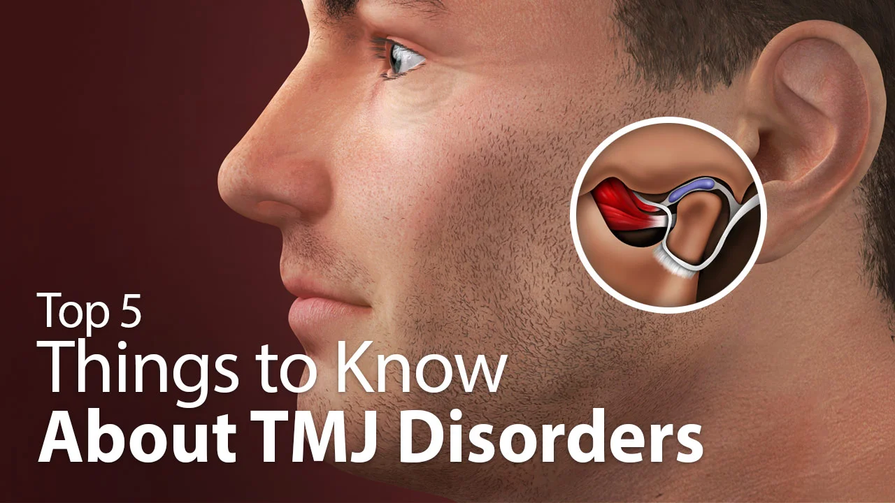 TMJ/TMD Treatments, Clicking or Popping Jaw Solutions in Lisle, IL